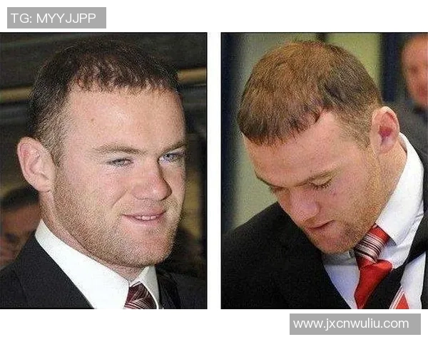 鲁尼植发背后的故事与足球生涯的转折点分析